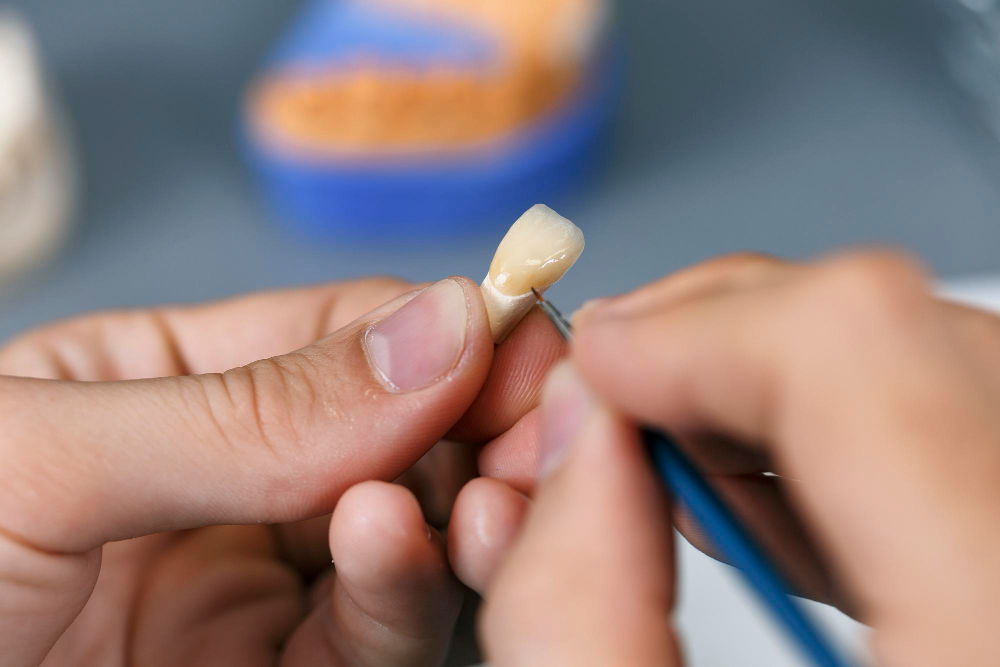 Toegewijde professionals voor uw glimlach